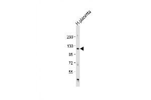 Western Blot at 1:1000 dilution + human placenta lysate Lysates/proteins at 20 ug per lane.