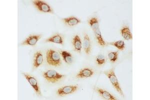 ICC testing of Cytochrome C antibody and A549 cells (Cytochrome C 抗体  (AA 91-105))