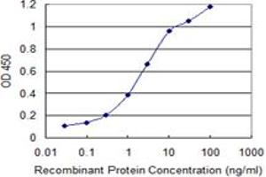 Detection limit for recombinant GST tagged MAGEB6 is 0. (MAGEB6 抗体  (AA 135-244))