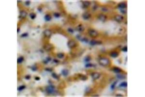 Used in DAB staining on fromalin fixed paraffin-embedded Kidney tissue (Decorin 抗体  (AA 31-359))