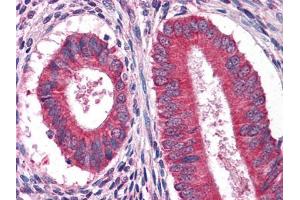Immunohistochemical analysis of paraffin-embedded human Uterus tissues using anFtEG mouse mAb (EGF 抗体)