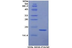 SDS-PAGE analysis of Human TFPI Protein. (TFPI 蛋白)
