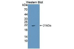 Detection of Recombinant IL1a, Human using Monoclonal Antibody to Interleukin 1 Alpha (IL1a) (IL1A 抗体  (AA 113-271))