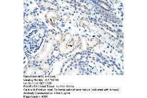 Human kidney (c-MYC 抗体  (N-Term))