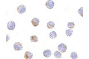 Immunofluorescence (IF) image for anti-DEAD (Asp-Glu-Ala-Asp) Box Polypeptide 3, X-Linked (DDX3X) (Intermediate Domain) antibody (ABIN499730)