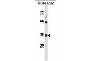 Western blot analysis in NCI-H292 cell line lysates (35ug/lane). (KCTD17 抗体  (AA 107-136))