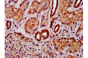 Immunohistochemistry (IHC) image for anti-Macrophage Migration Inhibitory Factor (Glycosylation-Inhibiting Factor) (MIF) (AA 2-115) antibody (ABIN7158882)