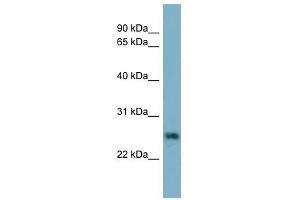 NTF5 antibody used at 1 ug/ml to detect target protein.