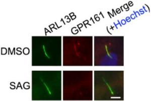 Semi-thin resin sections of the mouse retina were immunolabeled with affinity-purified mouse monoclonal antibody against Arl13b (NeuroMab) (H1,I1), rabbit polyclonal antibody against RIBEYE (U2656) (H2) and rabbit polyclonal antibody against PSD-95 (I2).