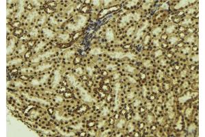 ABIN6277183 at 1/100 staining Mouse kidney tissue by IHC-P. (NADPH Oxidase 4 抗体  (Internal Region))