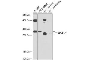 Western blot analysis of extracts of various cell lines, using SLC31 antibody (0109) at 1:1000 dilution. (SLC31A1 抗体  (AA 1-60))