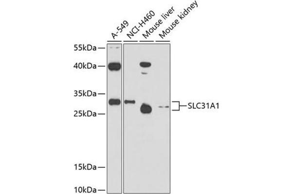 SLC31A1 抗体  (AA 1-60)