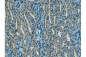 Detection of C1INH in Rat Kidney Tissue using Polyclonal Antibody to Complement 1 Inhibitor (C1INH)
