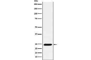 Western blot analysis of Bmf expression in Ramos cell lysate.