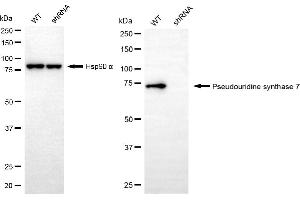 Western blotting analysis using pseudouridine synthase 7 antibody (ABIN7800059). (PUS7 抗体)