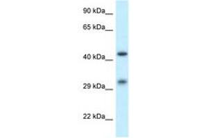 Image no. 1 for anti-Scavenger Receptor Class B, Member 2 (SCARB2) (AA 25-74) antibody (ABIN6749778) (SCARB2 抗体  (AA 25-74))