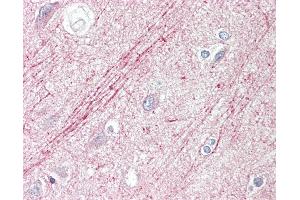 Anti-SLIT1 / SLIT-1 antibody IHC staining of human brain, cortex. (SLIT1 抗体  (AA 84-113))