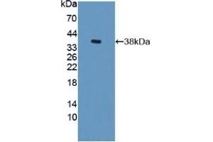 Western Blotting (WB) image for anti-Cytochrome P450, Family 17, Subfamily A, Polypeptide 1 (CYP17A1) (AA 201-507) antibody (ABIN7444547)