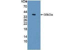 Detection of Recombinant S17aH, Rat using Polyclonal Antibody to Cytochrome P450 17A1 (CYP17A1) (CYP17A1 抗体  (AA 201-507))