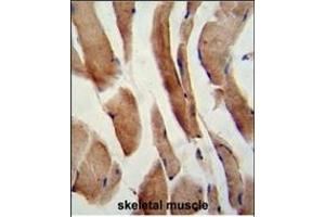 Formalin-fixed and paraffin-embedded human skeletal muscle reacted with CFLAR Antibody (Center), which was peroxidase-conjugated to the secondary antibody, followed by DAB staining. (FLIP 抗体  (AA 145-174))