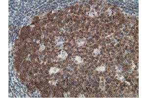 Image no. 1 for anti-Deoxycytidine Kinase (DCK) antibody (ABIN1497775) (DCK 抗体)