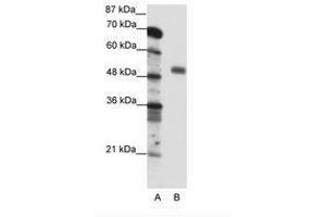 Image no. 1 for anti-Nuclear Transcription Factor Y, gamma (NFYC) (C-Term) antibody (ABIN6736095) (NFYC 抗体  (C-Term))