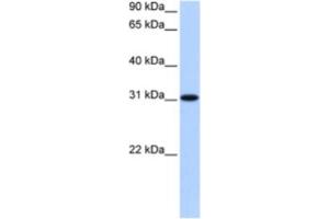 Western Blotting (WB) image for anti-Trinucleotide Repeat Containing 18 (TNRC18) antibody (ABIN2463465) (TNRC18 抗体)