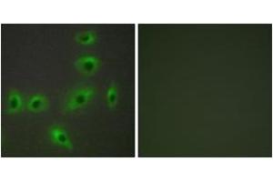 Immunofluorescence analysis of HuvEc cells, using BAX Antibody. (BAX 抗体  (AA 41-90))