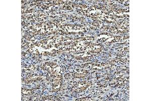 IHC analysis of hnRNP L/HNRNPL using anti-hnRNP L/HNRNPL antibody (ABIN7600130).