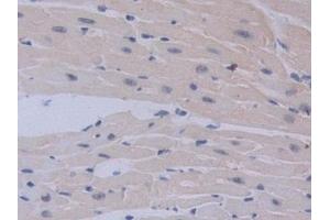 Immunohistochemistry (IHC) image for anti-Interleukin 12 alpha (IL12A) (AA 23-215) antibody (ABIN7430654)