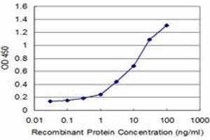 Detection limit for recombinant GST tagged TNKS is approximately 0. (TNKS 抗体  (AA 1017-1124))