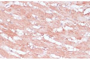Immunohistochemistry of paraffin-embedded Rat heart using RPL30 Polyclonal Antibody at dilution of 1:100 (40x lens). (RPL30 抗体)