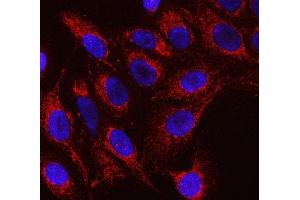 IF analysis of RFTN1 using anti-RFTN1 antibody (ABIN7600344). (RFTN1 抗体  (AA 18-437))