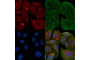 ABIN6258895 and ABIN6274392 staining Hela cells by IF/ICC. (FASTKD1 抗体  (Internal Region))