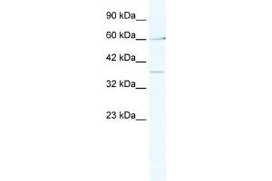 WB Suggested Anti-MTA1 Antibody Titration:  2. (MTA1 抗体  (Middle Region))