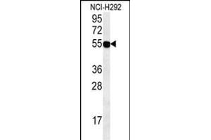 ZN Antibody (C-term) (ABIN654587 and ABIN2844288) western blot analysis in NCI- cell line lysates (35 μg/lane).