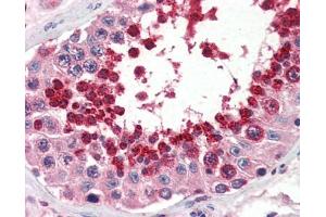 Immunohistochemistry (IHC) image for anti-Glutathione Peroxidase 4 (GPX4) (Middle Region) antibody (ABIN2787700) (GPX4 抗体  (Middle Region))