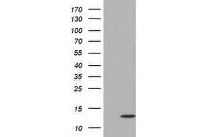 Western Blotting (WB) image for anti-Follicle Stimulating Hormone, beta Polypeptide (FSHB) antibody (ABIN1498320) (FSHB 抗体)