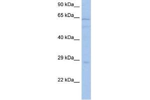 Western Blotting (WB) image for anti-Protein Kinase, AMP-Activated, alpha 1 Catalytic Subunit (PRKAA1) (Middle Region) antibody (ABIN2785500)