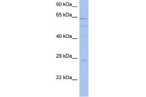 WB Suggested Anti-PRKAA1 Antibody Titration: 0. (PRKAA1 抗体  (Middle Region))