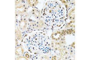 Immunohistochemistry of paraffin-embedded rat kidney using PNKP antibody (ABIN2564598) at dilution of 1:100 (40x lens). (PNKP 抗体)