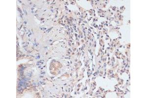Immunohistochemistry (Paraffin-embedded Sections) (IHC (p)) image for anti-Signal Transducer and Activator of Transcription 1, 91kDa (STAT1) (pSer727) antibody (ABIN7265092)