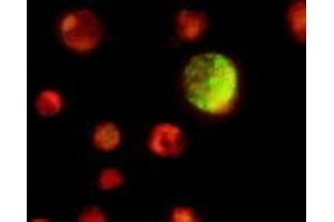 Immunofluorescence (IF) image for anti-Epstein-Barr Virus Viral Capsid Antigen gp110 (EBV VCA gp110) antibody (ABIN265548) (Epstein-Barr Virus Viral Capsid Antigen gp110 (EBV VCA gp110) 抗体)