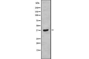 Western blot analysis of TAS2R38 using COLO205 whole cell lysates (TAS2R38 抗体  (Internal Region))