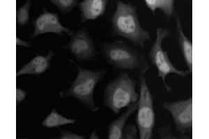 Immunofluorescent staining of HeLa (ATCC CCL-2) cells. (SKP1 抗体  (AA 4-158))