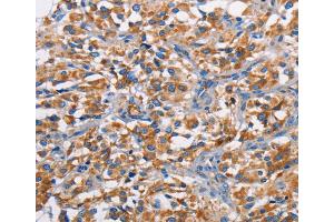 Immunohistochemistry (IHC) image for anti-Proto-Oncogene Pim-2 (Serine Threonine Kinase) (PIM2) antibody (ABIN2422823) (PIM2 抗体)