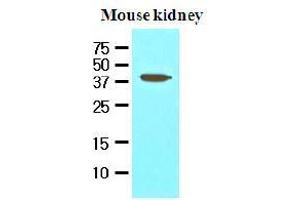 Western Blotting (WB) image for anti-Apoptosis, Caspase Activation Inhibitor (AVEN) (AA 254-362) antibody (ABIN336089) (AVEN 抗体  (AA 254-362))