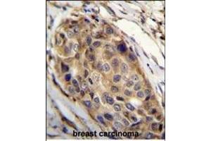 Immunohistochemistry (Paraffin-embedded Sections) (IHC (p)) image for anti-Slingshot Homolog 3 (SSH3) (AA 575-602), (C-Term) antibody (ABIN655643)