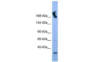 NUP155 antibody used at 0. (NUP155 抗体  (N-Term))