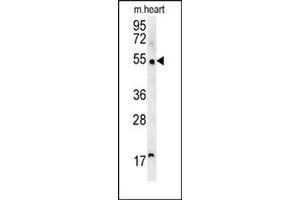 Western blot analysis of SCARA5 Antibody (C-term) Cat. (SCARA5 抗体  (C-Term))